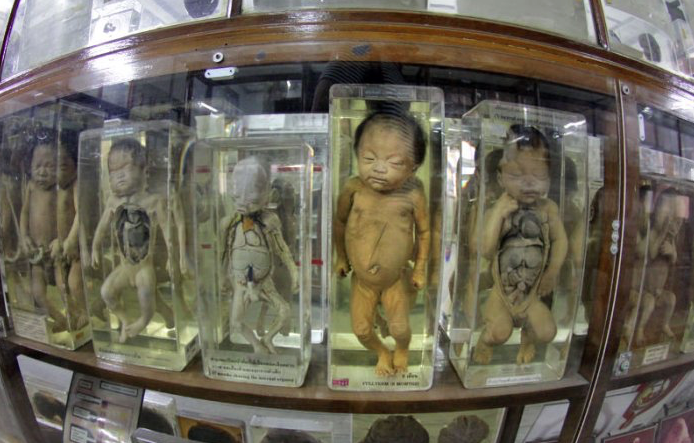 objects at the Forensic museum